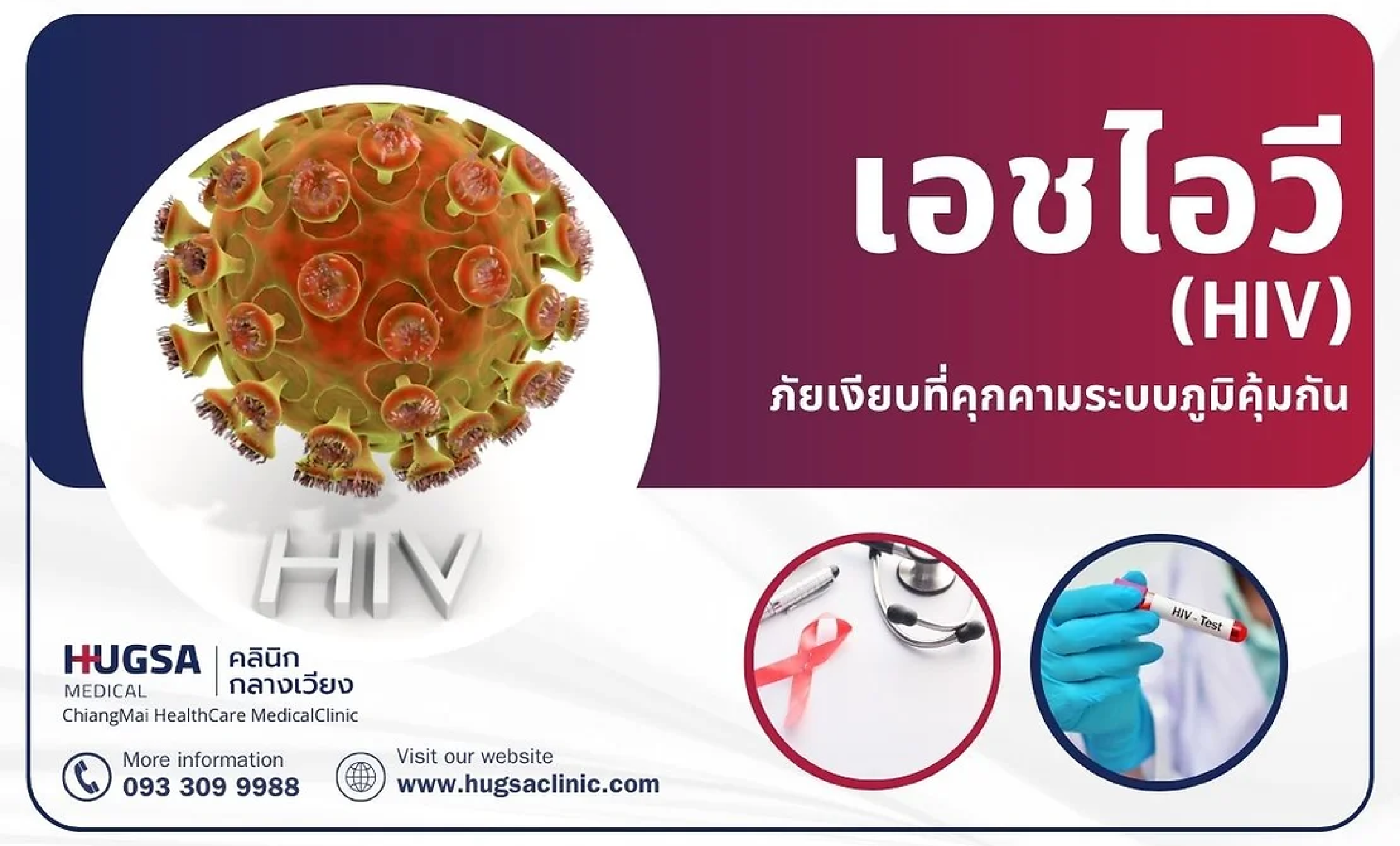 เอชไววี (HIV)